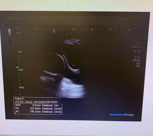 d2989ead535c39970e7c3f588737c03